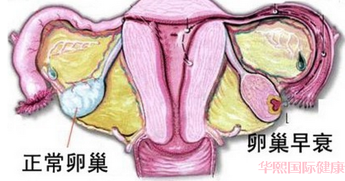 卵巢早衰,染色体异常,供卵自怀健康的龙凤胎 卵巢早衰,染色体异常,供卵自怀健康的龙凤胎