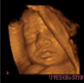 30岁右侧卵巢被切除,选择包生儿子方案喜获一枚小王子,太不容易了 30岁右侧卵巢被切除,选择包生儿子方案喜获一枚小王子,太不容易了