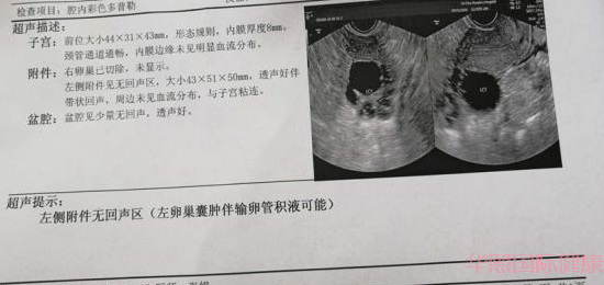 30岁右侧卵巢被切除,选择包生儿子方案喜获一枚小王子,太不容易了 30岁右侧卵巢被切除,选择包生儿子方案喜获一枚小王子,太不容易了